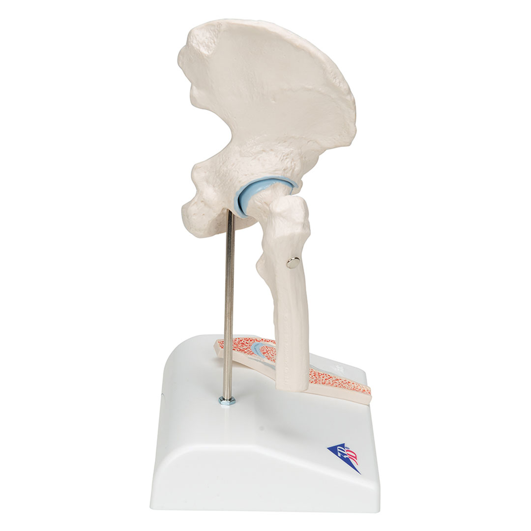 3B SCIENTIFIC Mini-Hüftgelenk m.Querschnitt (A84/1)