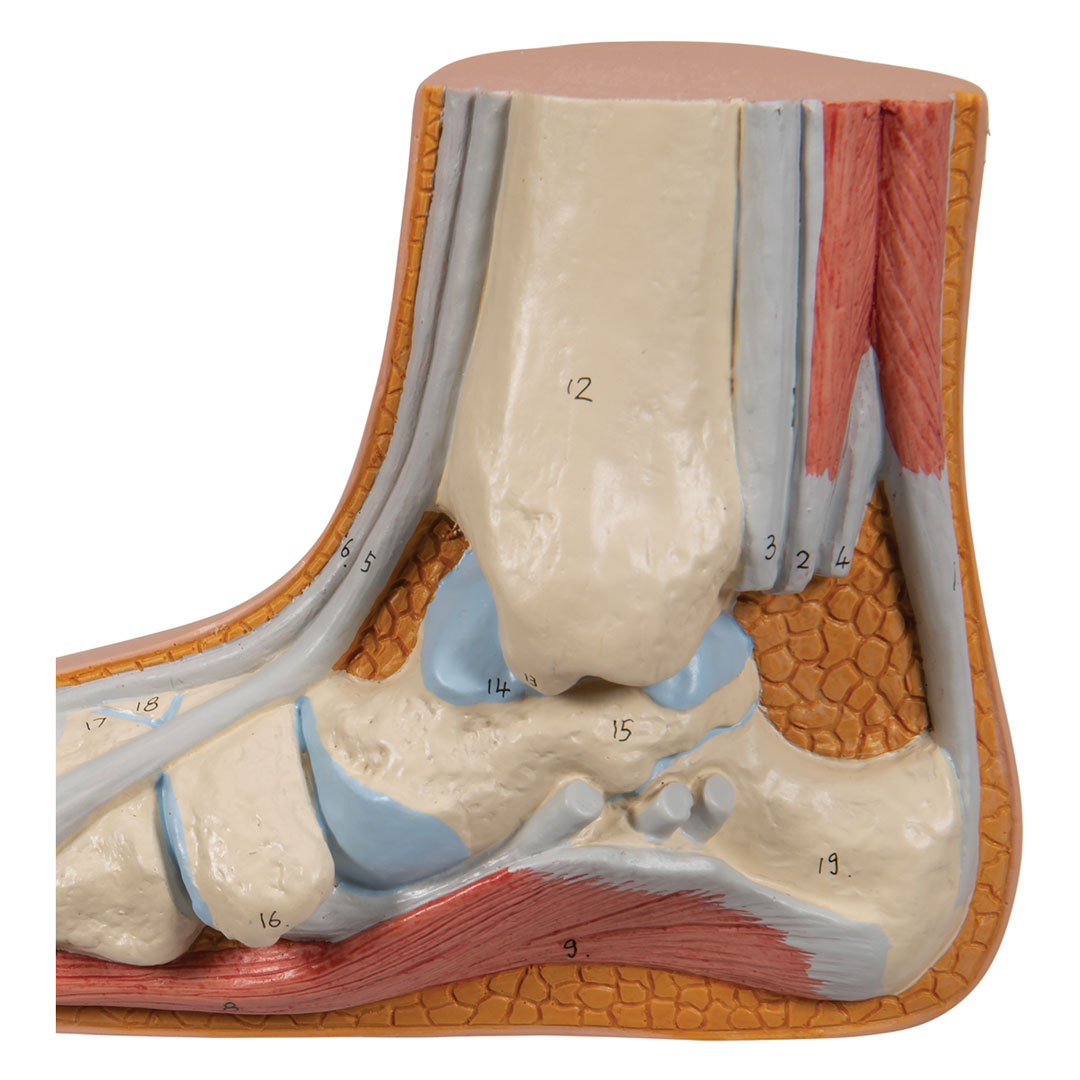 3B SCIENTIFIC Plattfuss, natürl. Grösse (M31)
