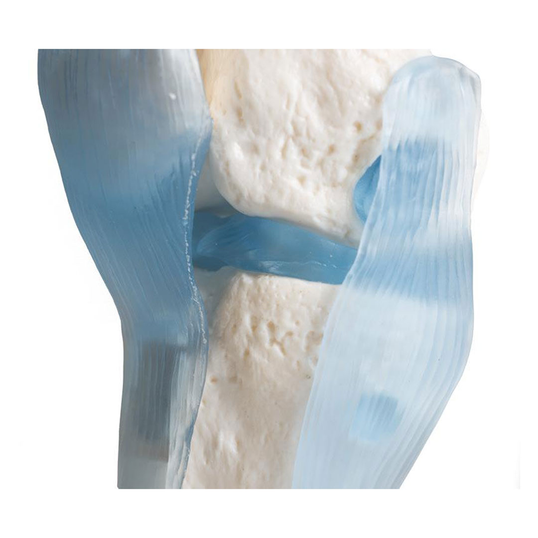 ERLER ZIMMER Kniegelenk auf Stativ mit Stümpfen