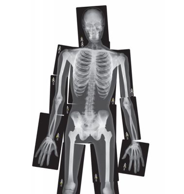 Röntgenbilder Mensch, lebensgross, 18teilig