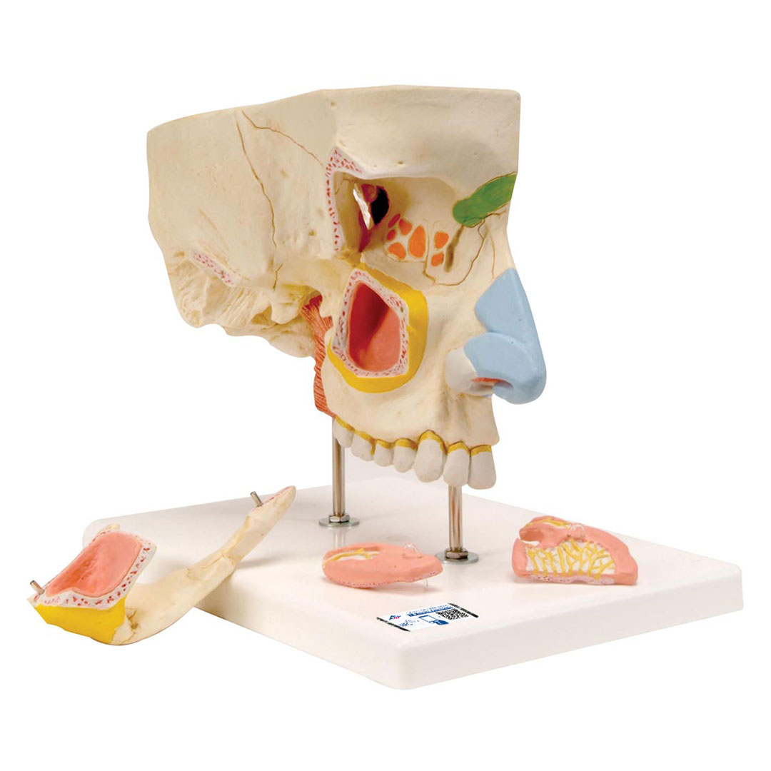 3B SCIENTIFIC Nase mit Nasennebenhöhlen, 5-teilig (E20), Grösse 26x19x24cm
