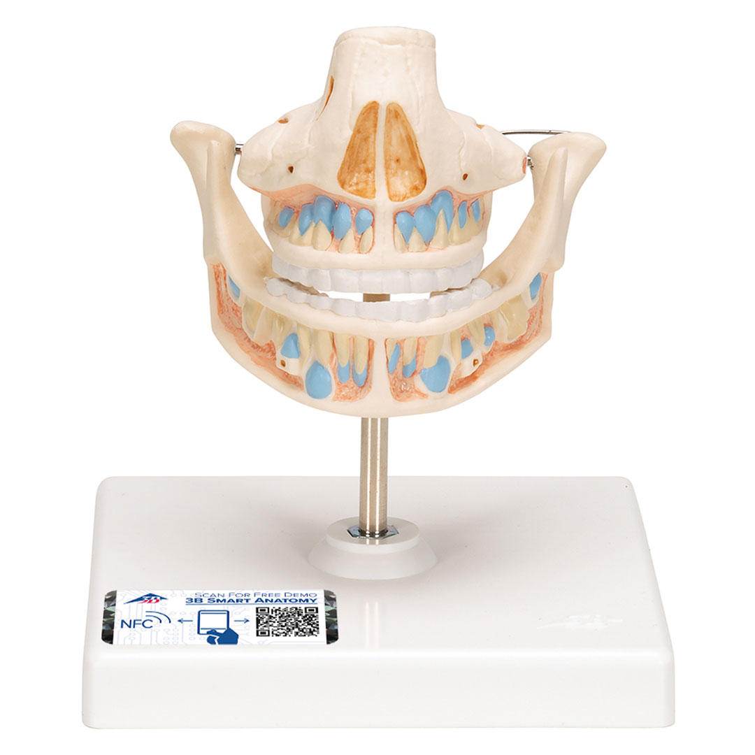 3B SCIENTIFIC Ober- und Unterkiefer, Kind (VE282)