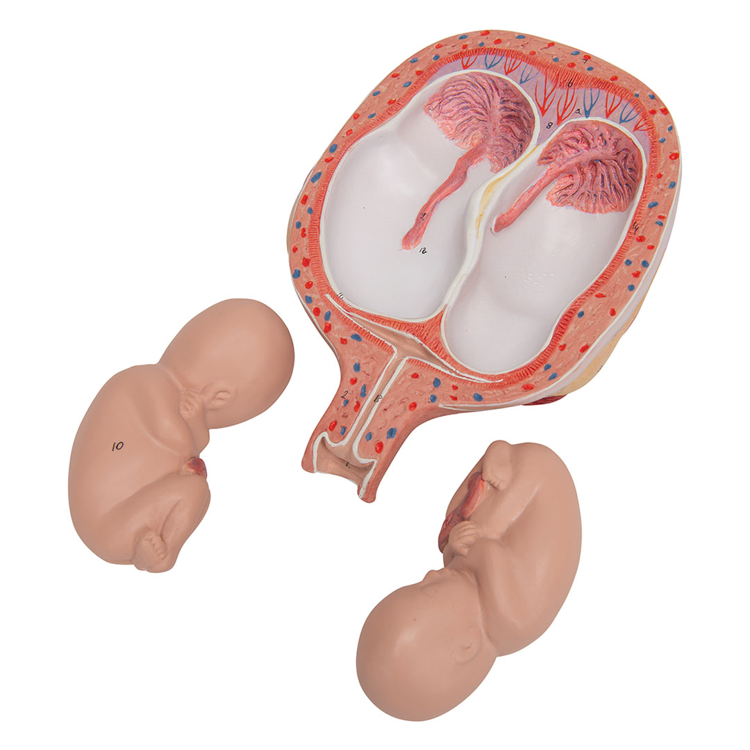 3B SCIENTIFIC Uterus mit Zwillingsfeten, 3-tlg (L10/7)