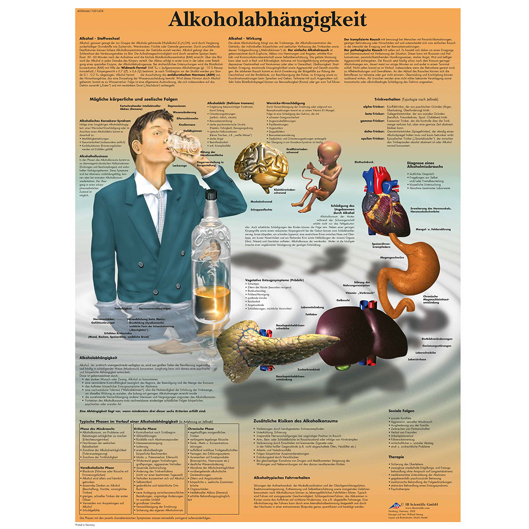 3B SCIENTIFIC Lehrtafel Alkoholabhängigkeit 50x67cm
