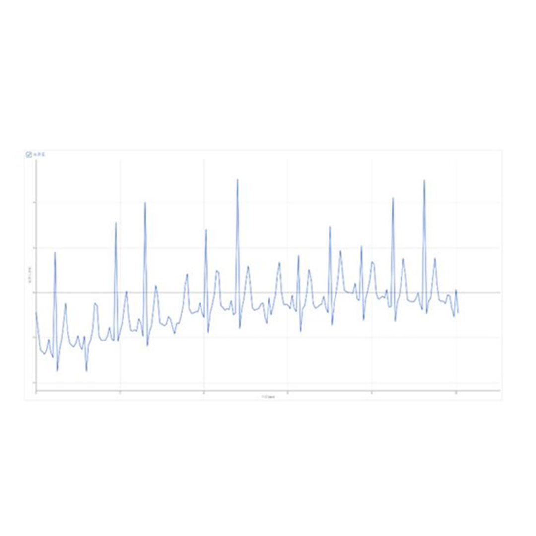 WLD Sensor, EKG (Herzrhythmus)