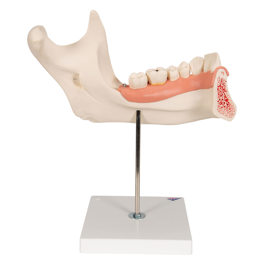 3B SCIENTIFIC Unterkiefer 6-tlg. (D25), 3-fach