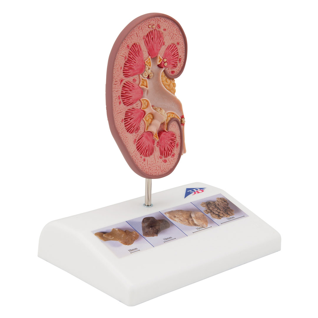 3B SCIENTIFIC Nierensteinmodell (K29)