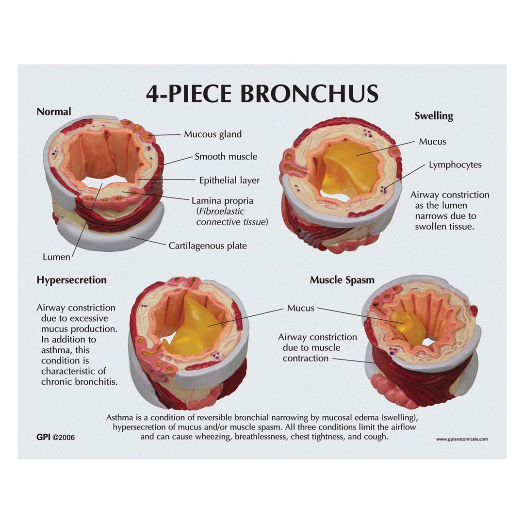 3B SCIENTIFIC Bronchusmodell 4-teilig, (W33362)