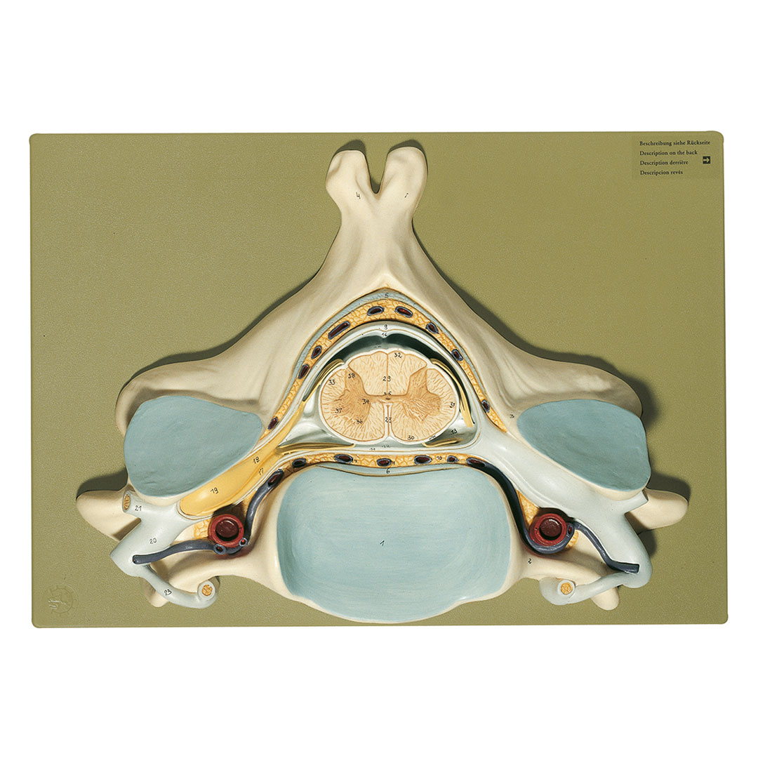 SOMSO® Fünfter Halswirbel