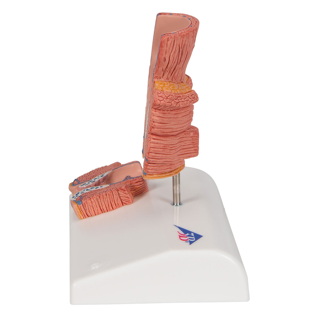 3B SCIENTIFIC Hämorrhoidenmodell (K27)
