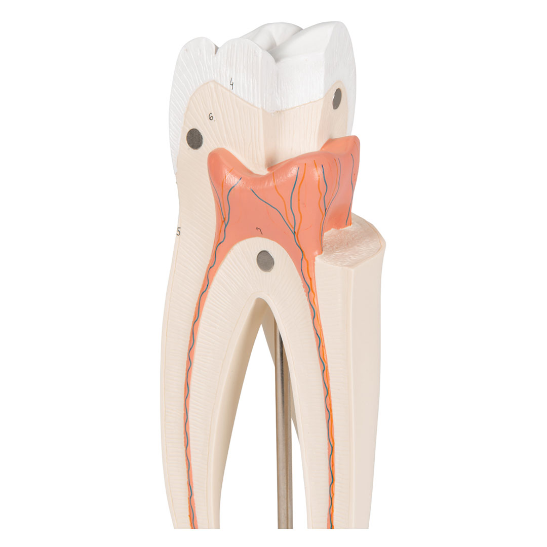 3B SCIENTIFIC Mahlzahn, oben, dreiwurzelig, 3-teilig (D10/5)