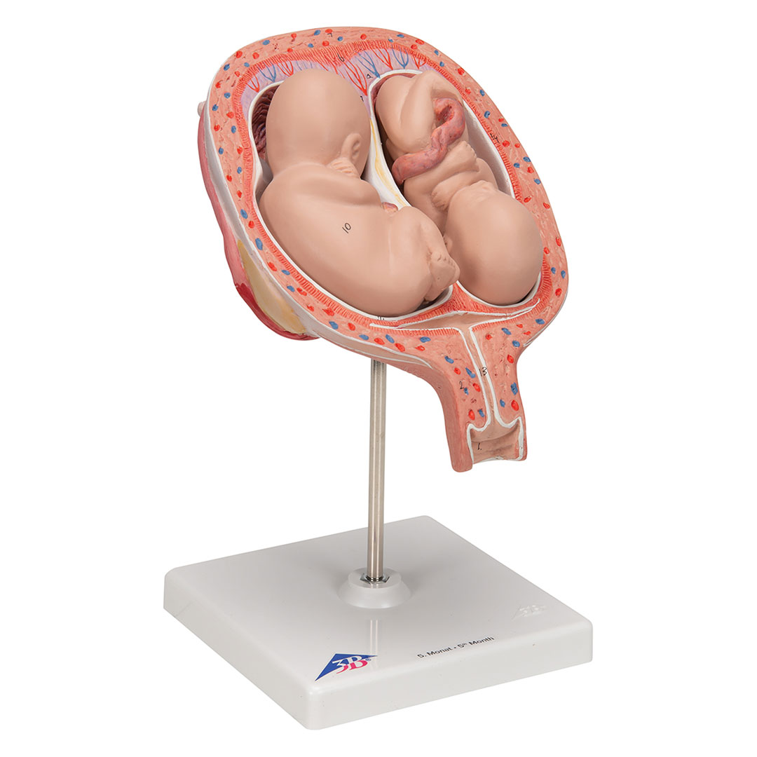 3B SCIENTIFIC Uterus mit Zwillingsfeten, 3-tlg (L10/7)