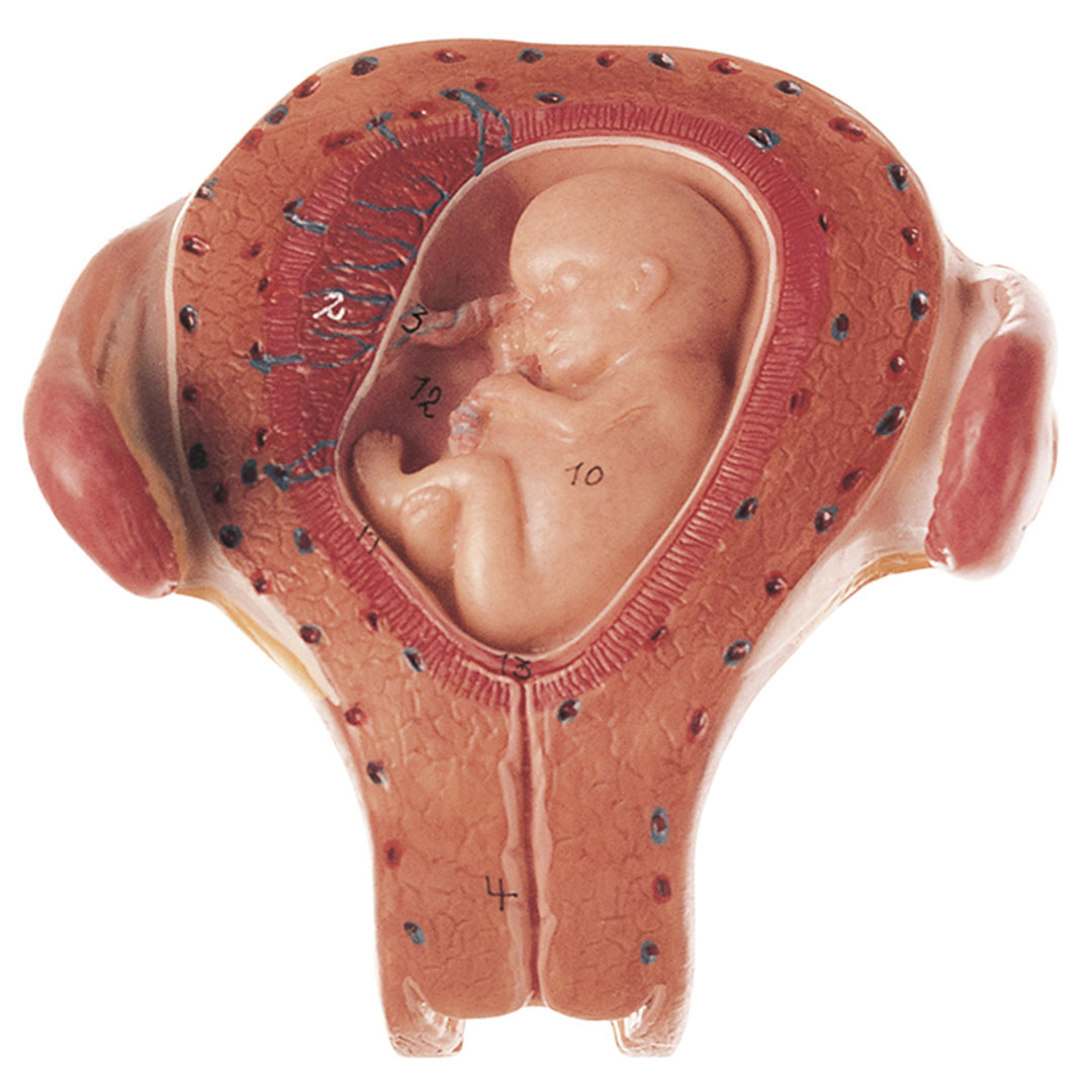 SOMSO® Embryo im 3. Monat