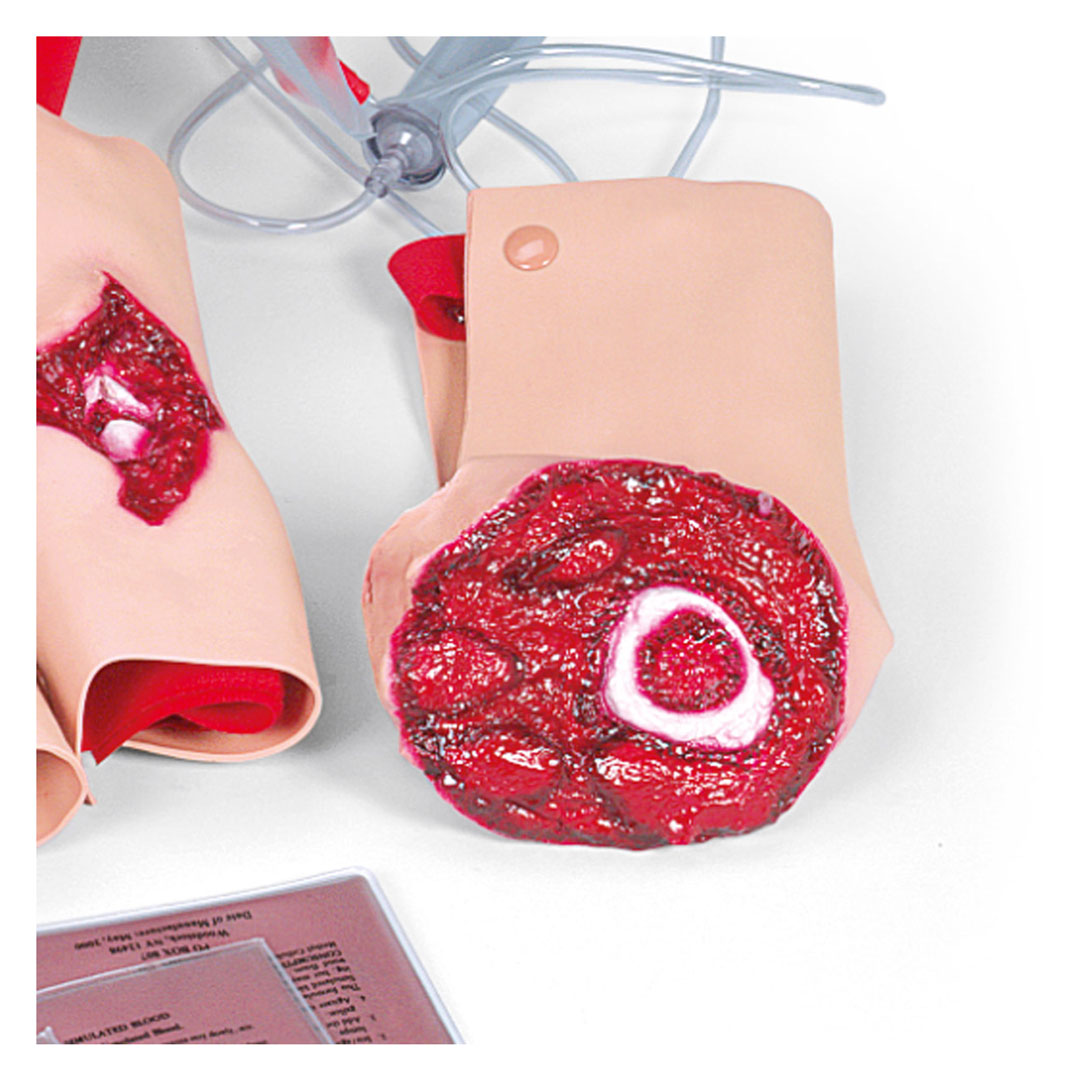 3B SCIENTIFIC Wundensimulations-Set II