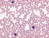 Blutausstrich Schnellfärbekit, 3x100ml