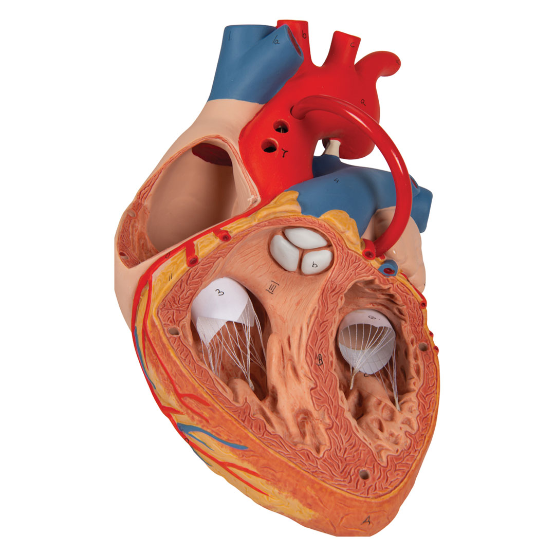 3B SCIENTIFIC Herzmodell m. Bypass, 4-tlg.2-fach v (G06)