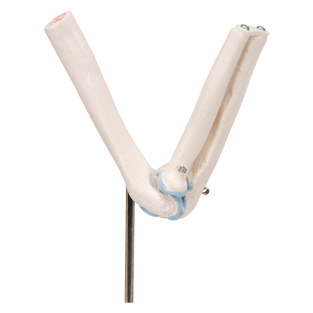 3B SCIENTIFIC Mini-Ellbogengelenk m.Querschnitt (A87/1)