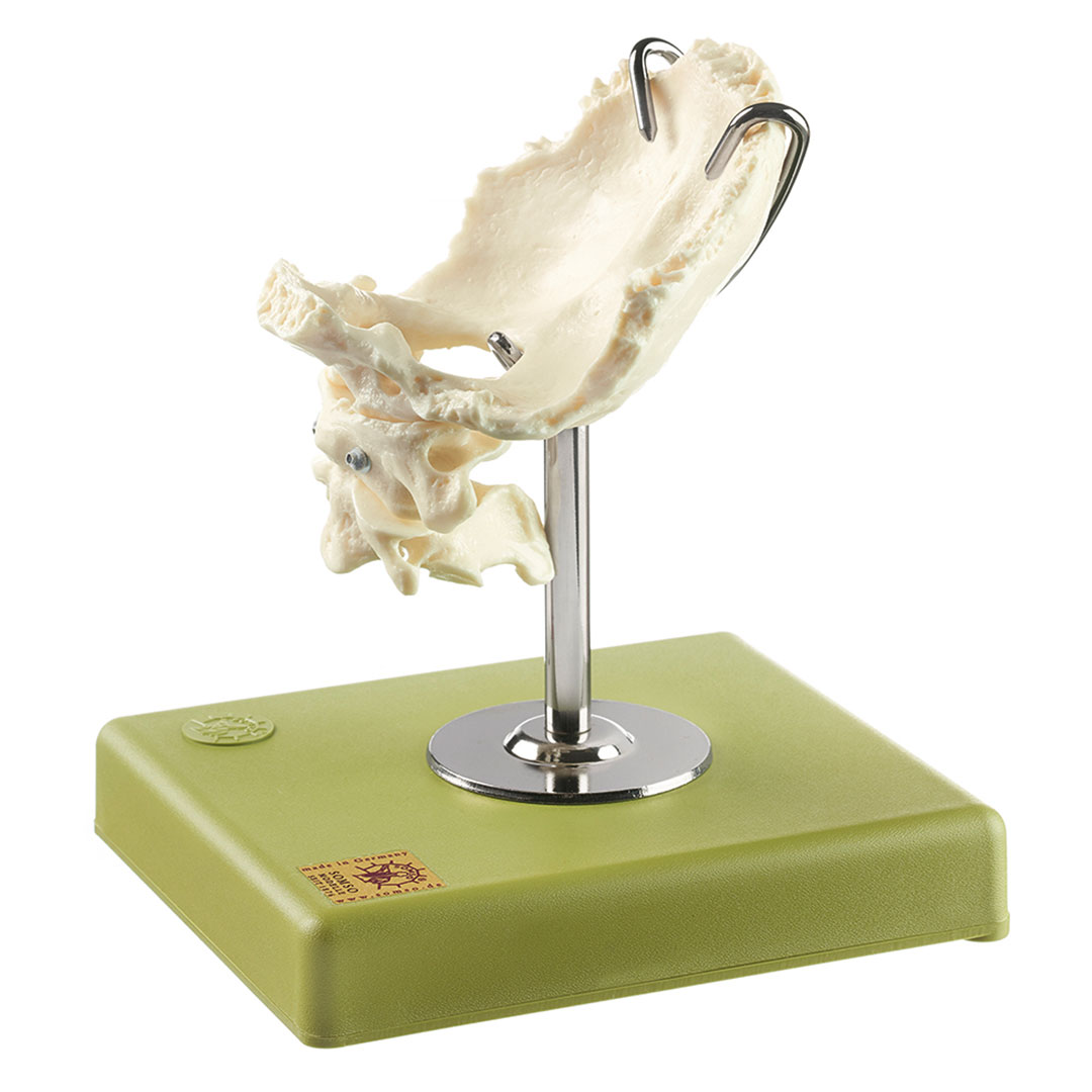 SOMSO® Atlas, Axis und Hinterhaupt