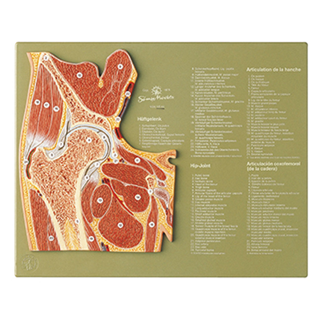 SOMSO® Gelenkschnitt Hüftgelenk SOMSO® Gelenkschnitt Hüftgelenk