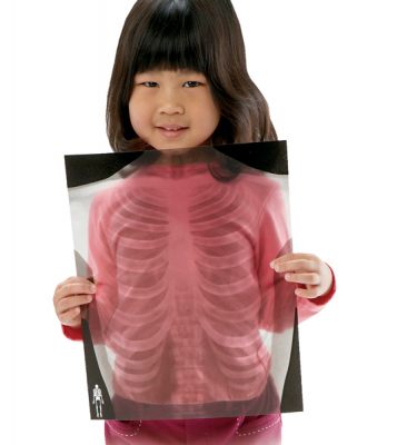 Röntgenbilder Mensch, lebensgross, 18teilig