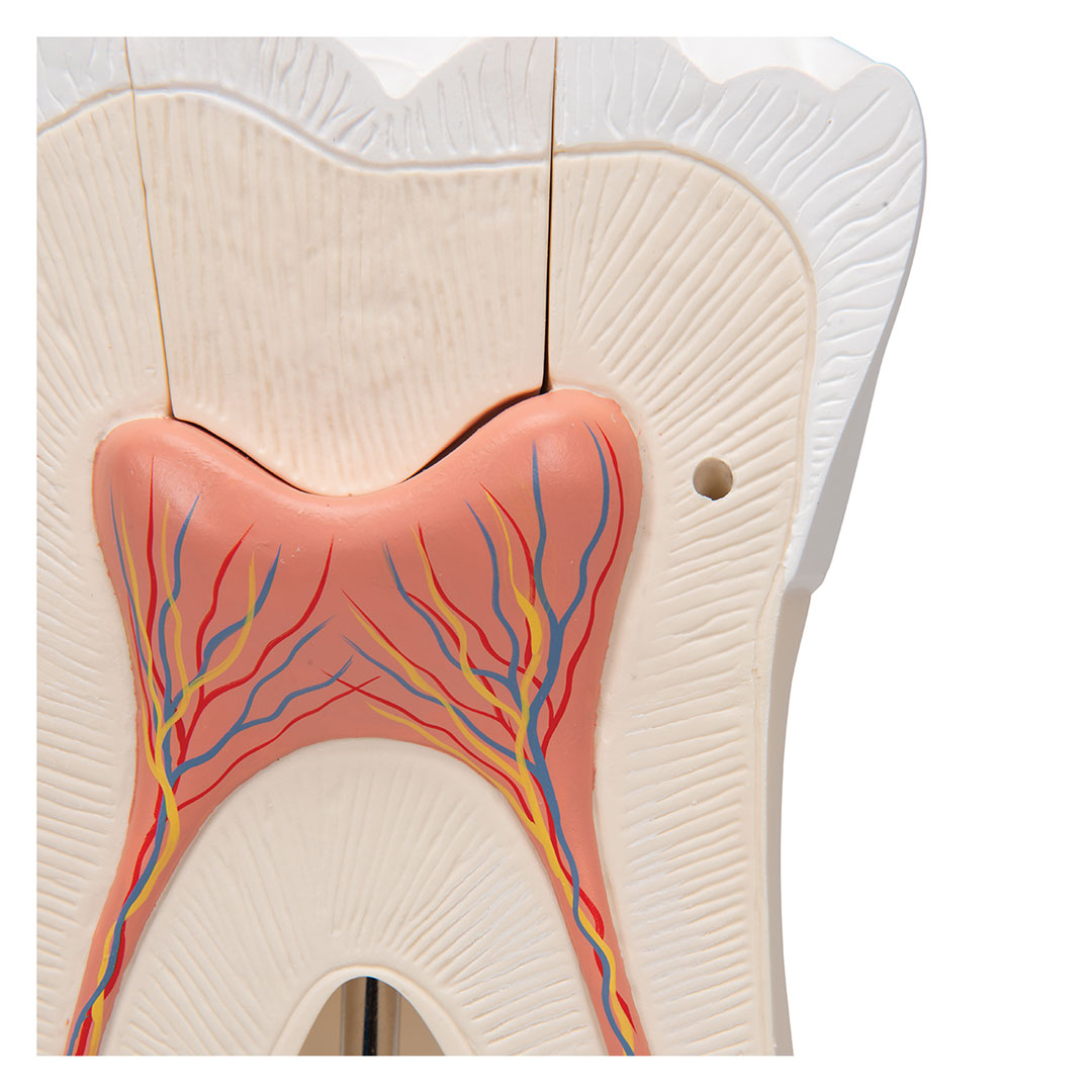 3B SCIENTIFIC Mahlzahn, oben, dreiwurzelig, 5-tlg. (D15)