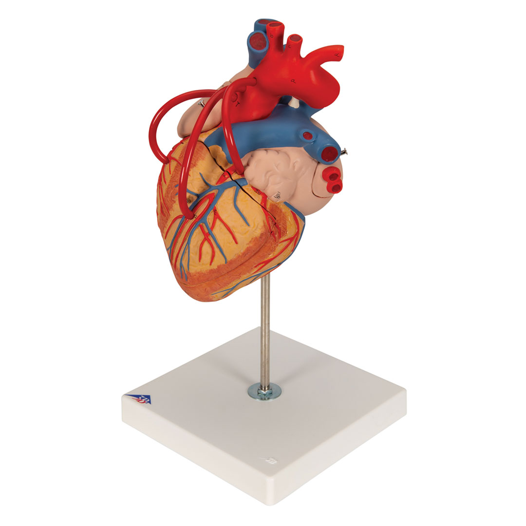 3B SCIENTIFIC Herzmodell m. Bypass, 4-tlg.2-fach v (G06)