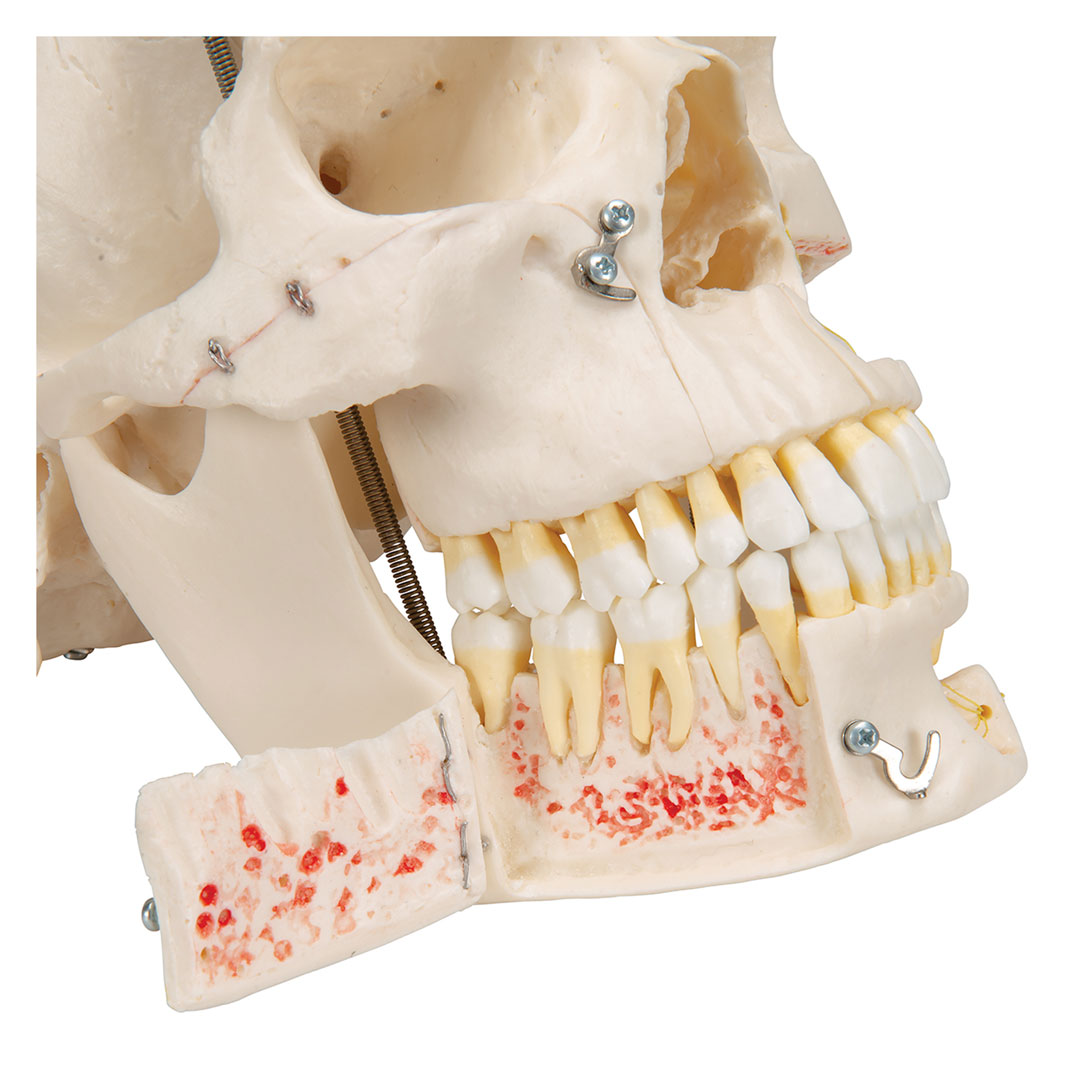 3B SCIENTIFIC Schädel, Demo, 10-teilig, Zähne herausn. (A27)