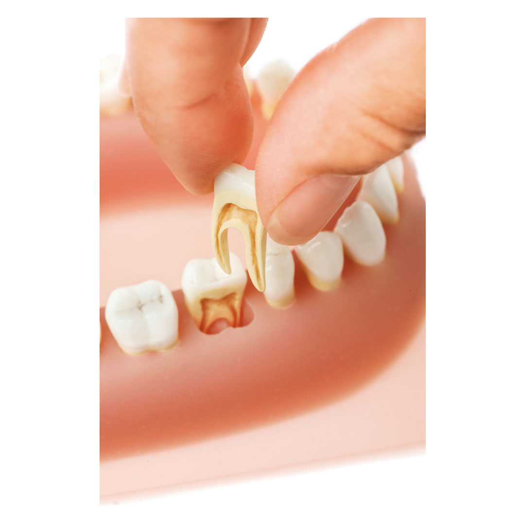 SOMSO® Erwachsenengebiss,32 Kunststoffzähne*