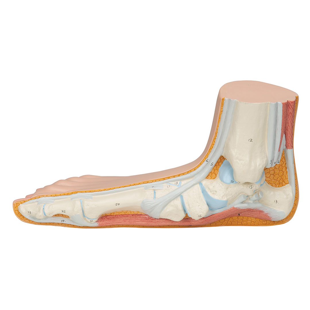 3B SCIENTIFIC Plattfuss, natürl. Grösse (M31)