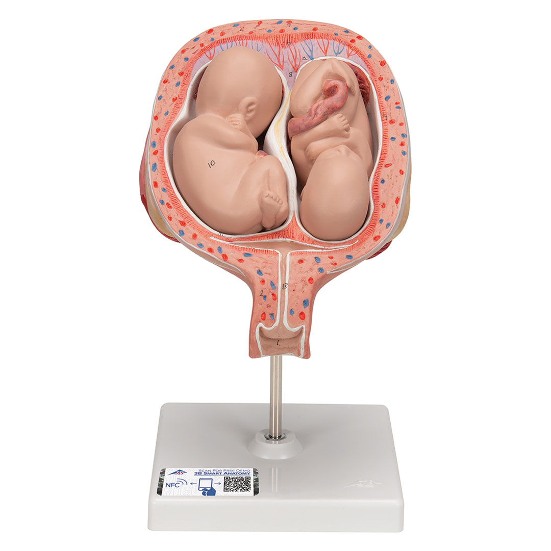 3B SCIENTIFIC Uterus mit Zwillingsfeten, 3-tlg (L10/7)