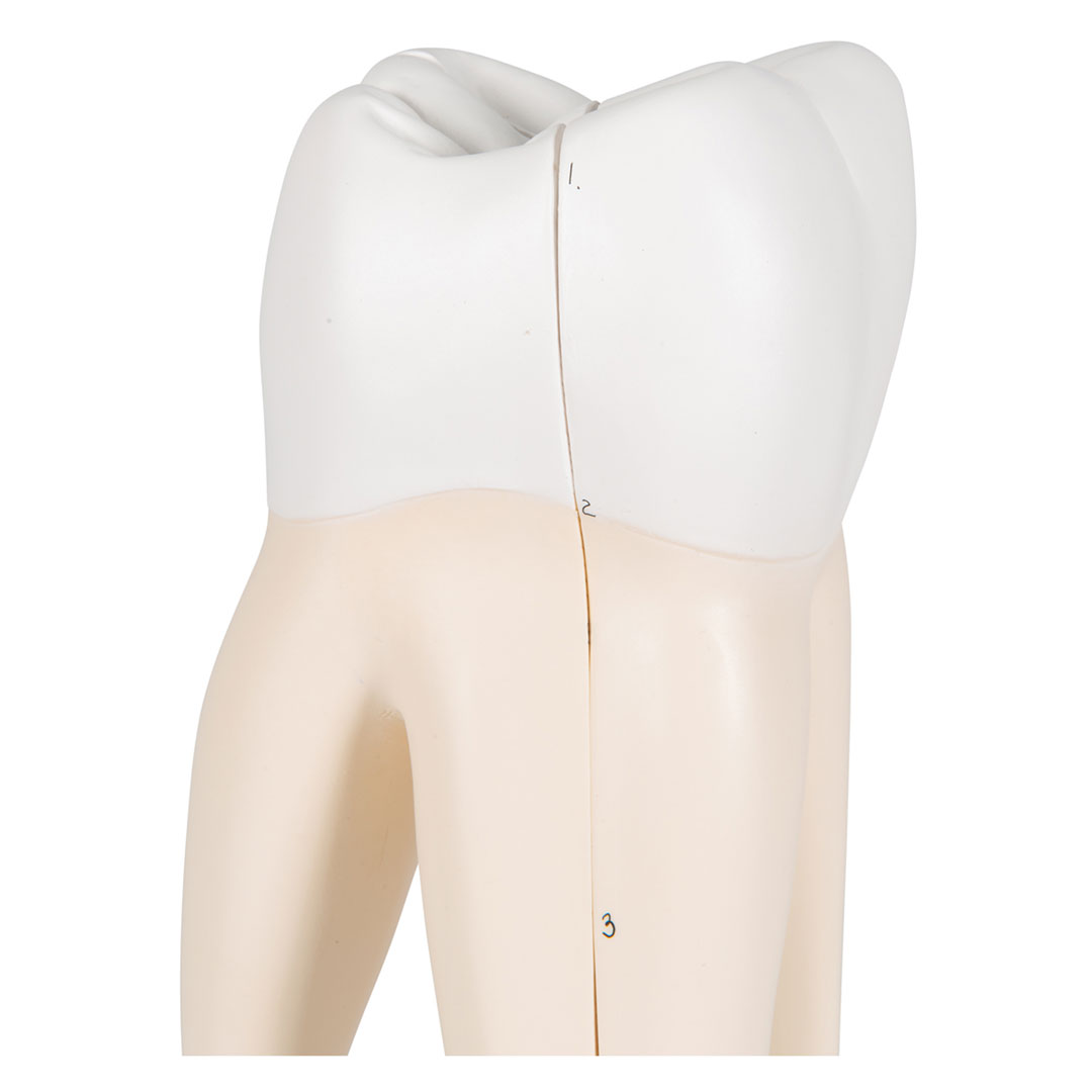 3B SCIENTIFIC Mahlzahn, oben, dreiwurzelig, 3-teilig (D10/5)