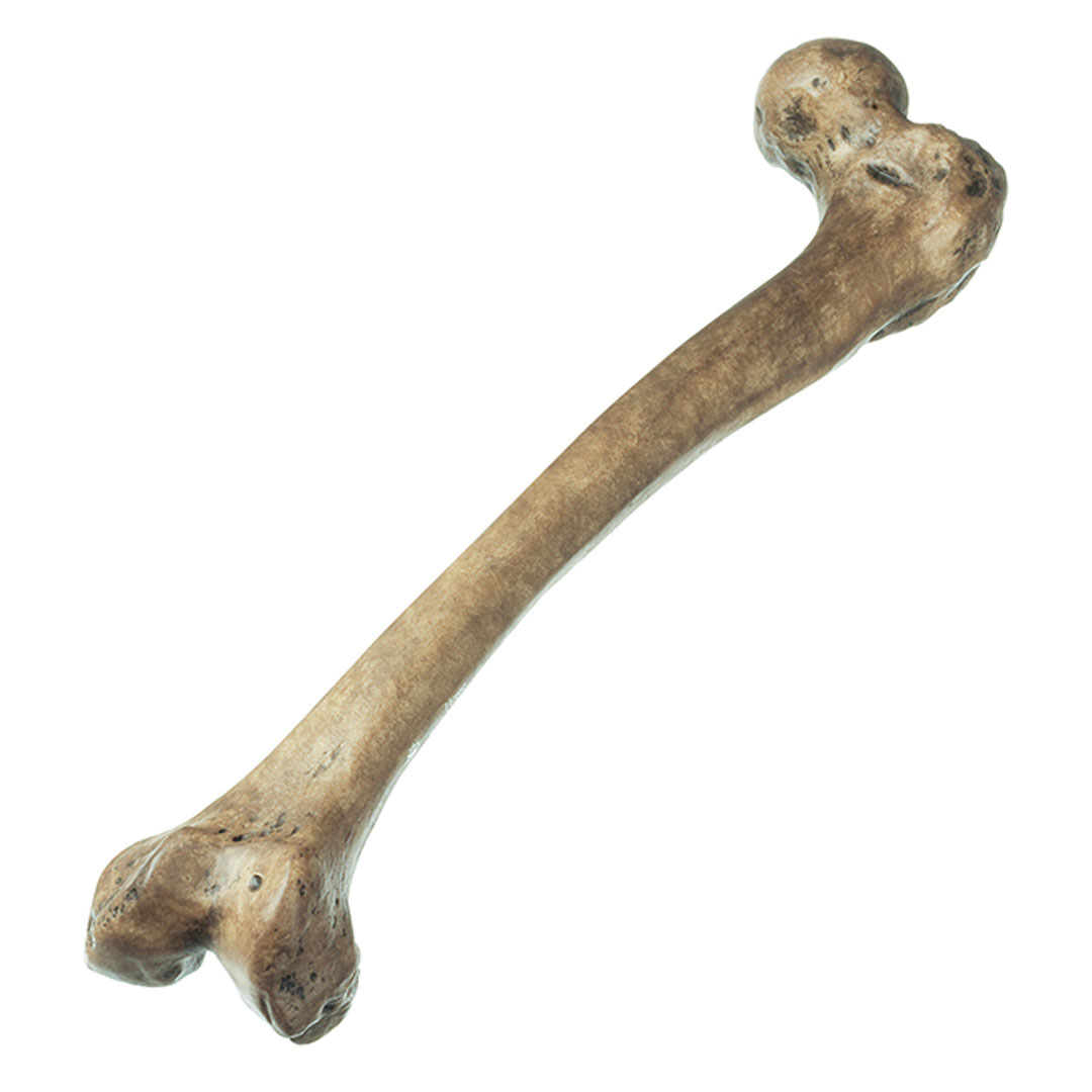 SOMSO® Oberschenkelrekonstruktion  Home Neanderthalensis