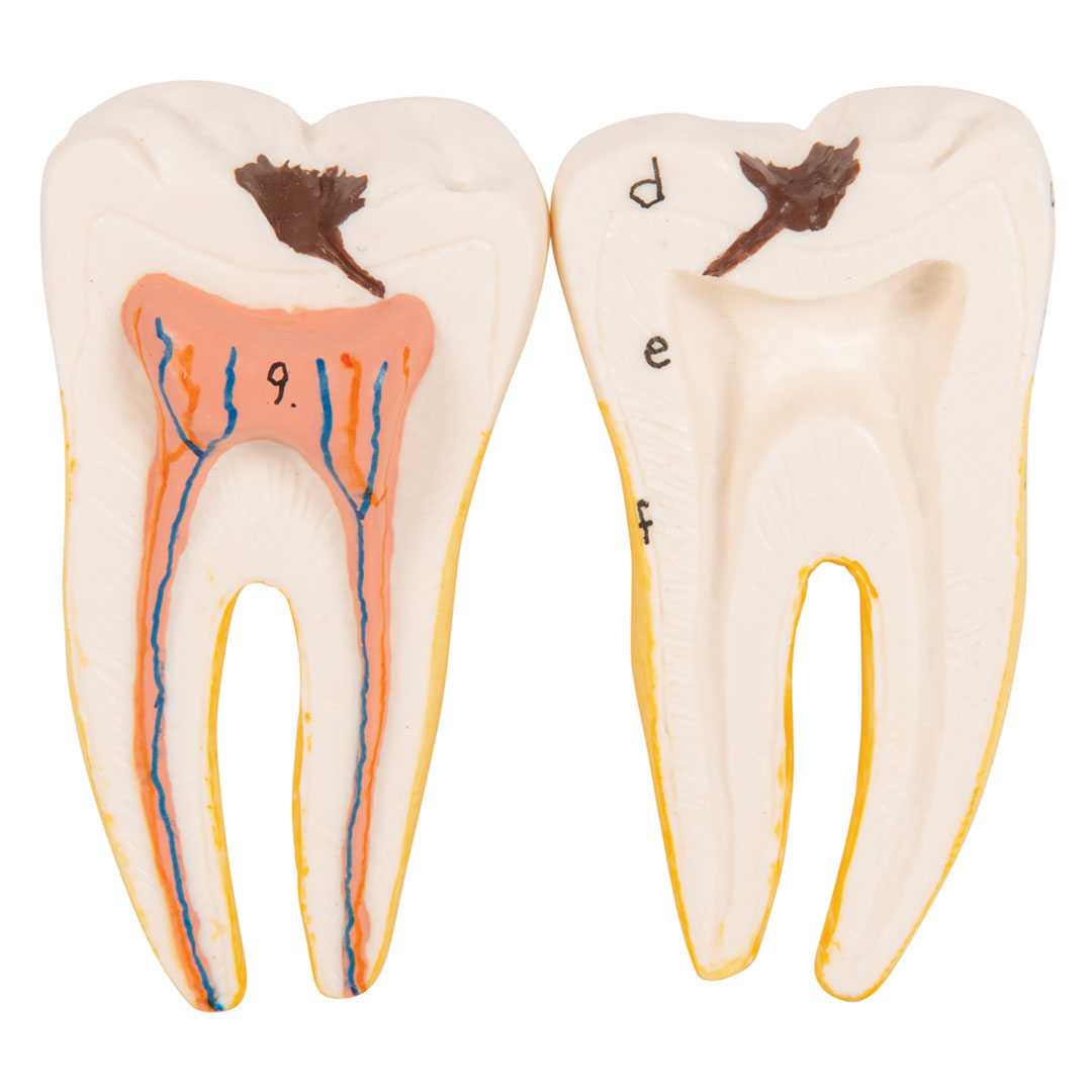 3B SCIENTIFIC Unterkiefer 6-tlg. (D25), 3-fach