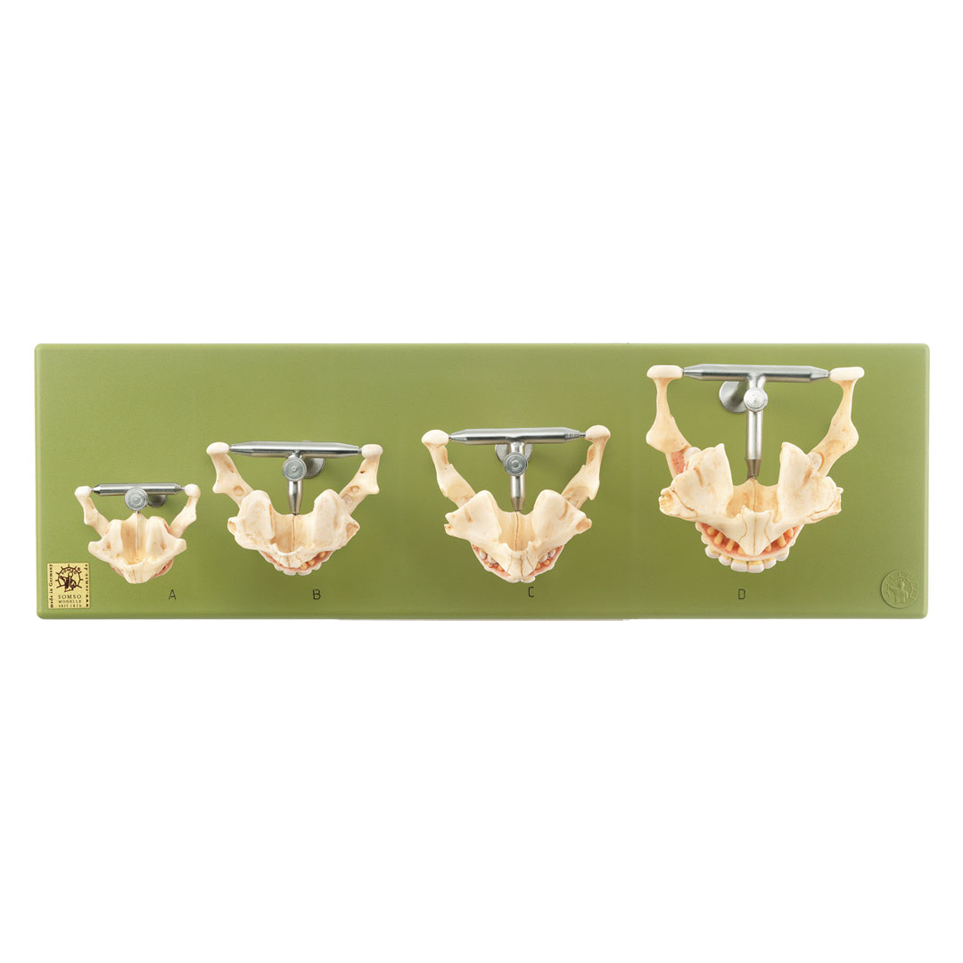 SOMSO® Gebissentwicklung*