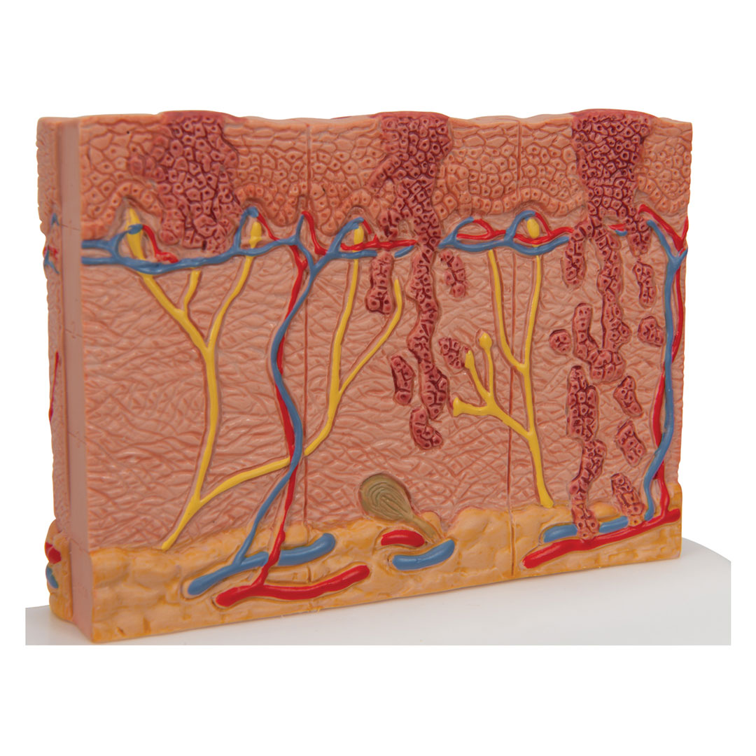 3B SCIENTIFIC Hautkrebs-Modell (J15)