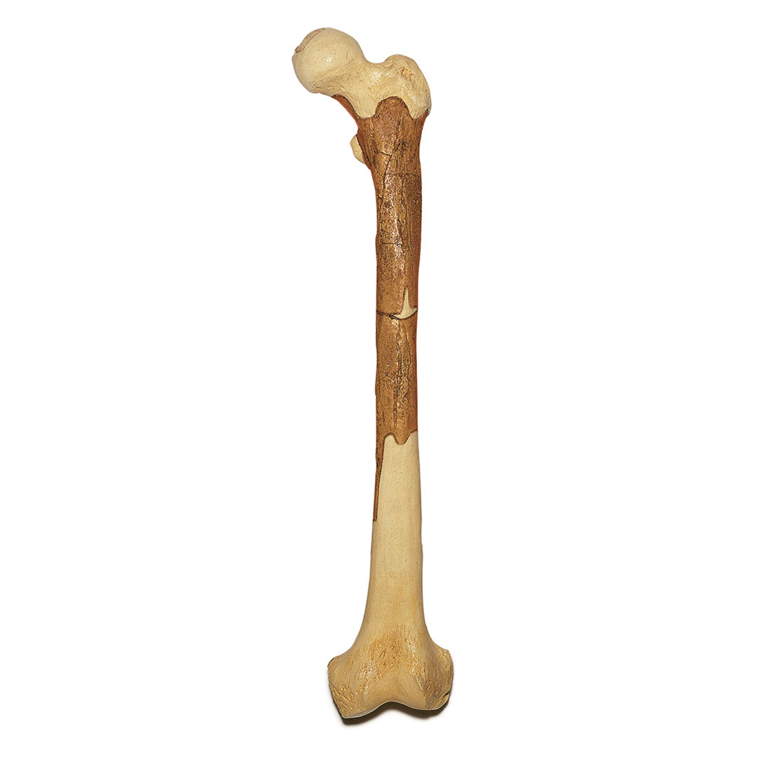 SOMSO® Oberschenkelrekonstruktion  Homo Ergaster