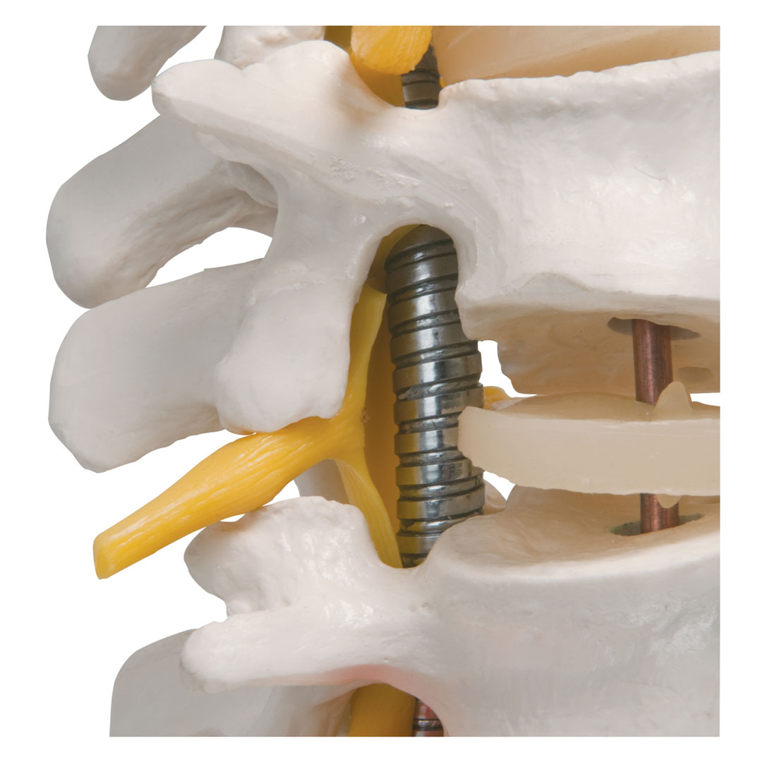 3B SCIENTIFIC Wirbelsäule für starke Beanspruchung, H=74cm (A59/1)