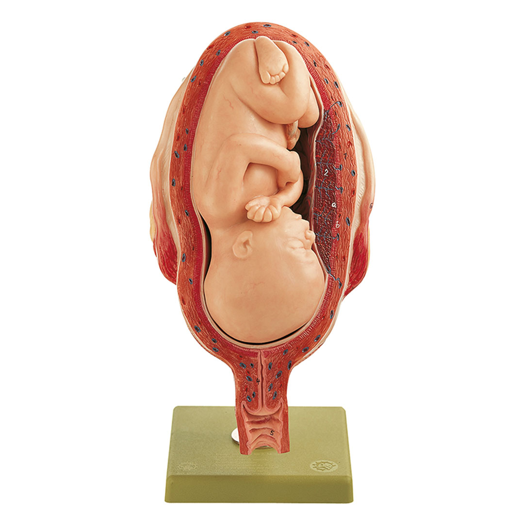 SOMSO® Uterus m. Fetus im 7. Monat