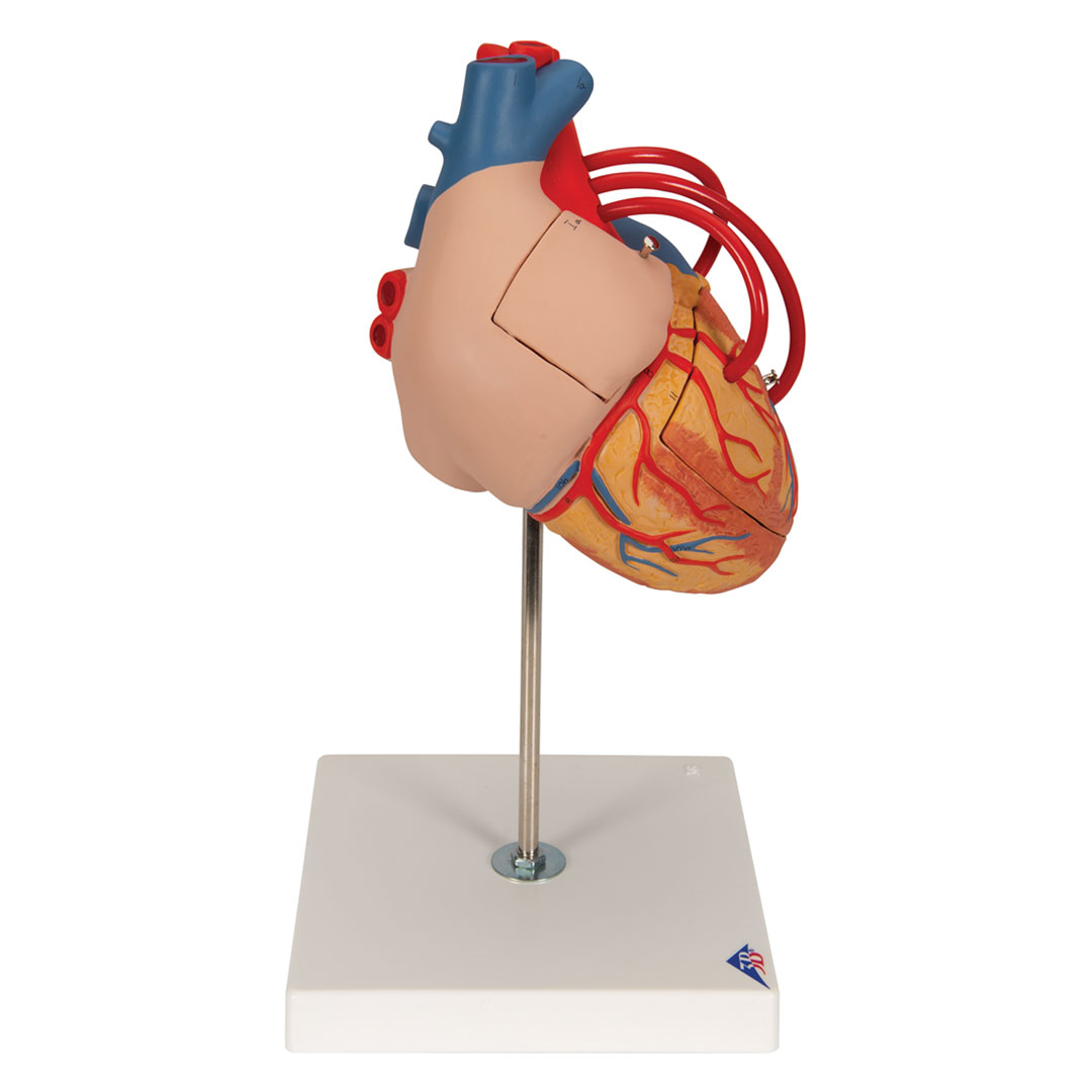 3B SCIENTIFIC Herzmodell m. Bypass, 4-tlg.2-fach v (G06)