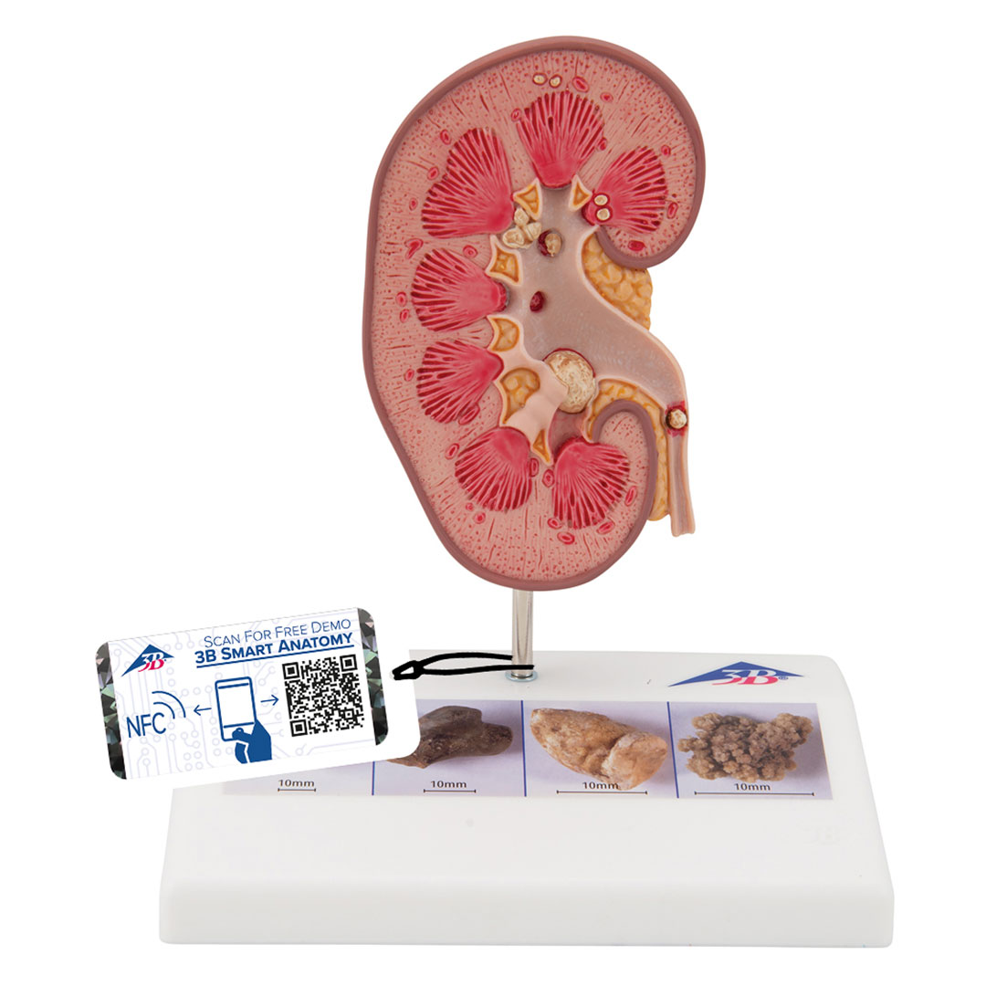 3B SCIENTIFIC Nierensteinmodell (K29)