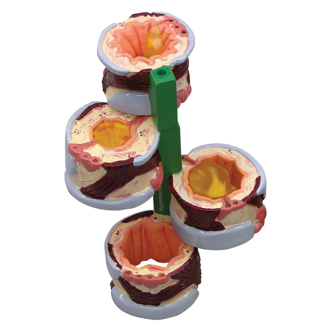 3B SCIENTIFIC Bronchusmodell 4-teilig, (W33362)