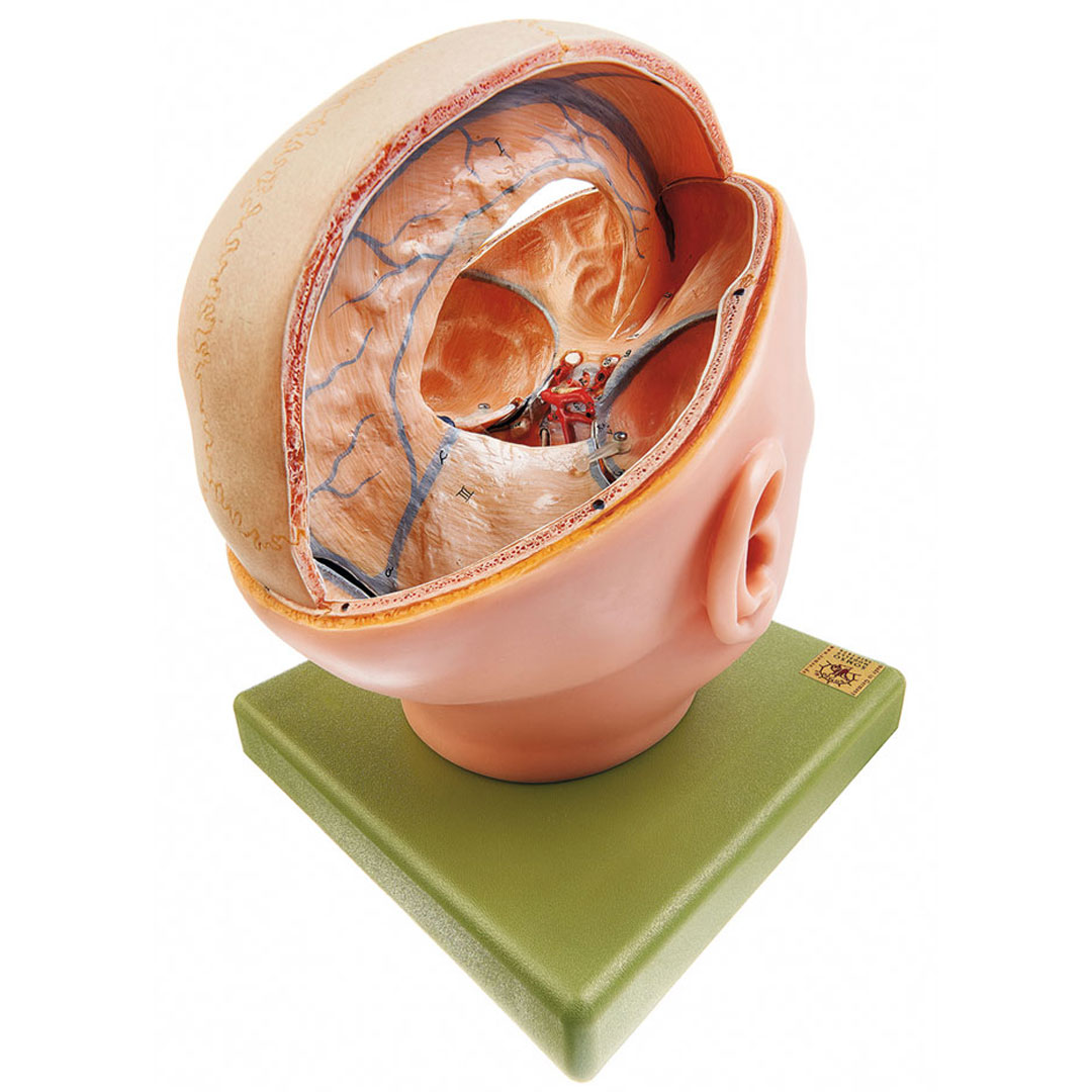 SOMSO® Duraverhältnisse Schädel, Modell