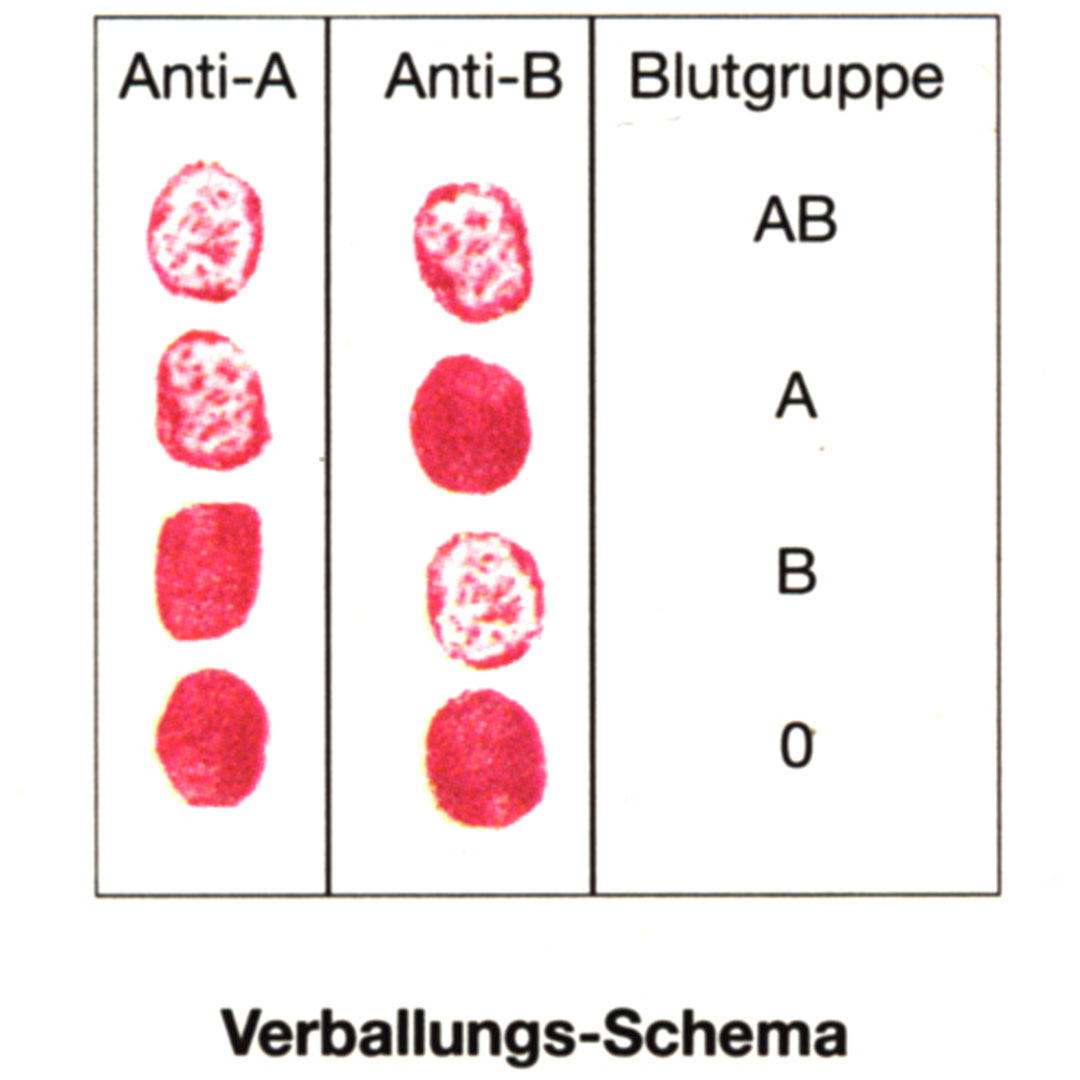 Künstliches Blut mit Rhesus Kit de Luxe