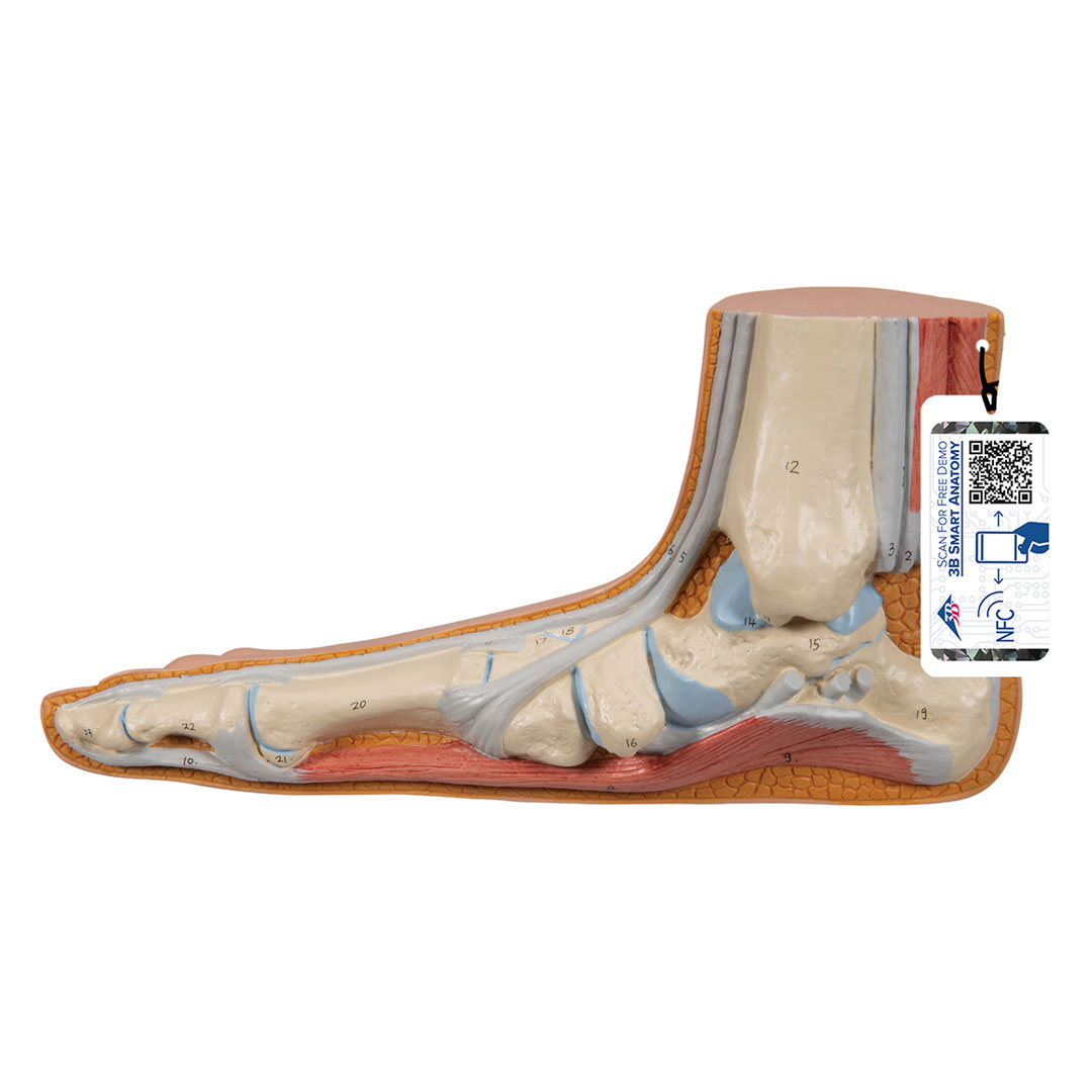 3B SCIENTIFIC Plattfuss, natürl. Grösse (M31)