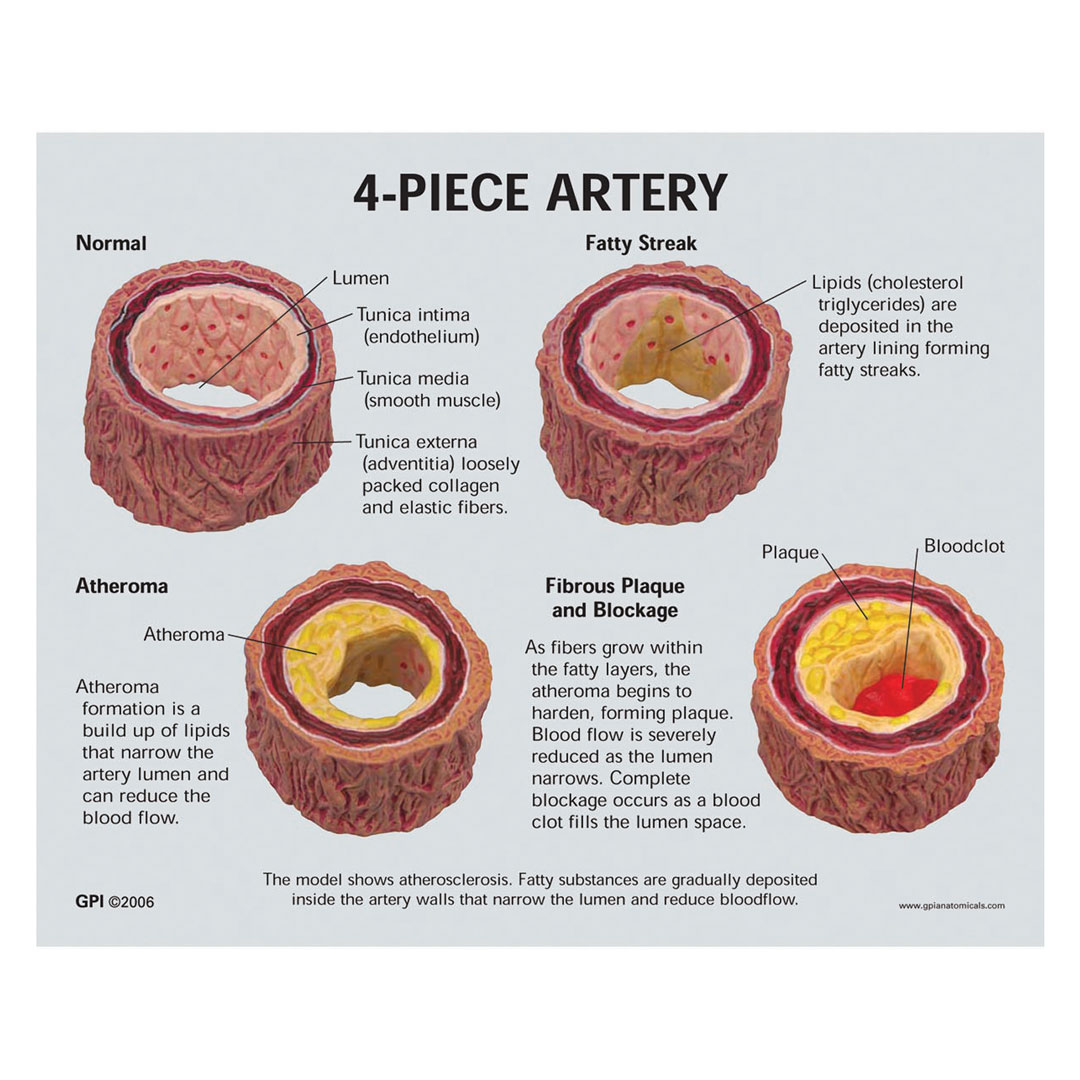 3B SCIENTIFIC Arterienabschnitte (4) (überdimensioniert) - mit Griff