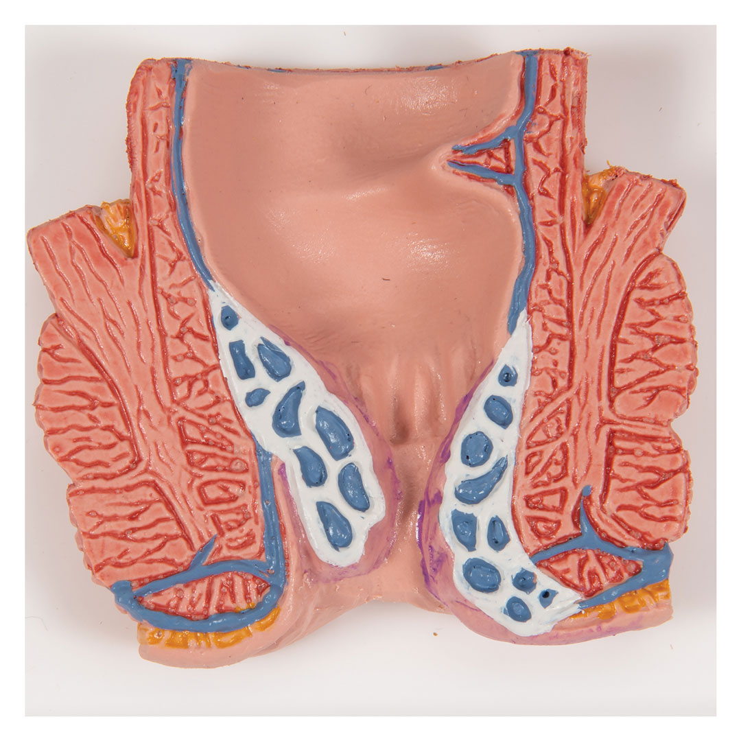 3B SCIENTIFIC Hämorrhoidenmodell (K27)