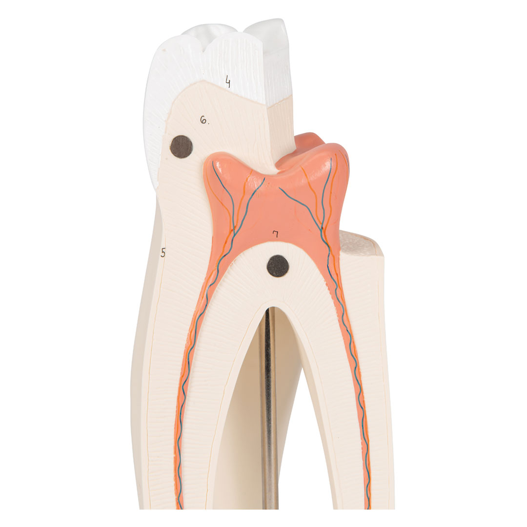 3B SCIENTIFIC Mahlzahn, oben, dreiwurzelig, 3-teilig (D10/5)
