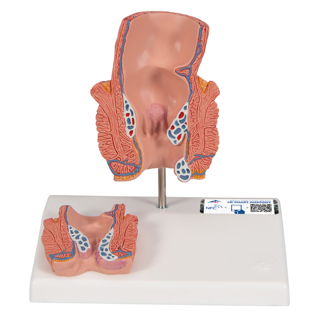 3B SCIENTIFIC Hämorrhoidenmodell (K27)