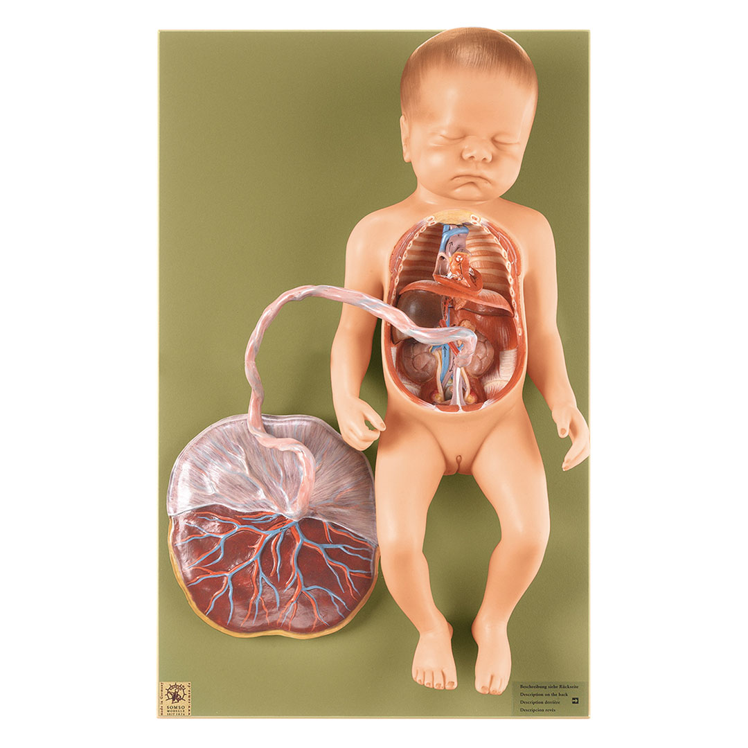 SOMSO® Fetaler Blutkreislauf
