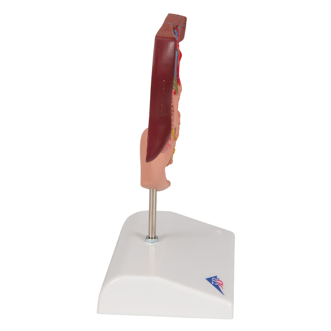 3B SCIENTIFIC Gallensteine, Modell (K26)